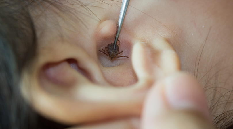 Dr. Shruti Sharma, is the best ENT specialist doctor, for removal of Foreign bodies, entered into ear, nose or throat, at (Pedder Road and Tardeo) Mumbai.